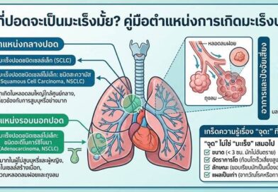“เจอจุดที่ปอด” ต้องกังวลแค่ไหน?